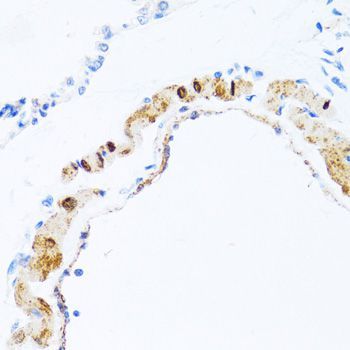 Immunohistochemistry - PHPT1 antibody (144-01127)