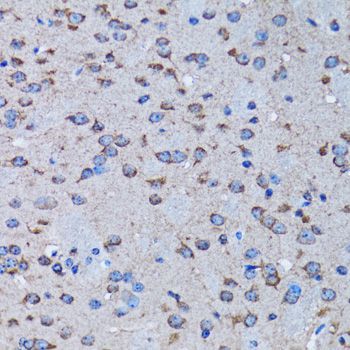 Immunohistochemistry - IRAK4 antibody (144-06208)