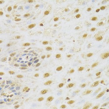 Immunohistochemistry - RUNX1 Antibody (144-02055)