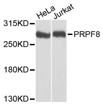Western blot - PRPF8 Polyclonal Antibody (144-06053)