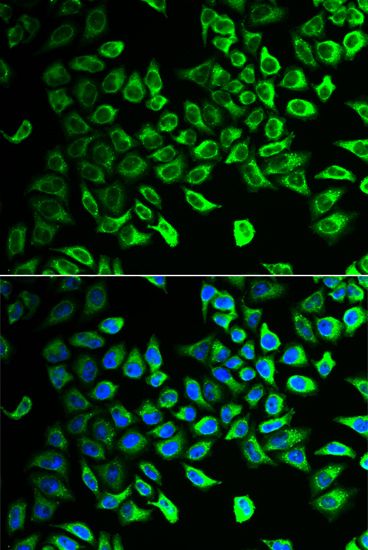 Immunofluorescence - DDAH2 Polyclonal Antibody (144-06457)