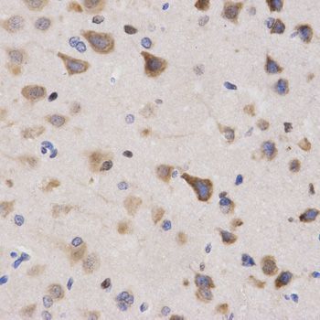Immunohistochemistry - KPNA4 Antibody (144-02026)