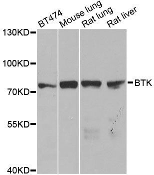 Western blot - BTK antibody (144-012738)