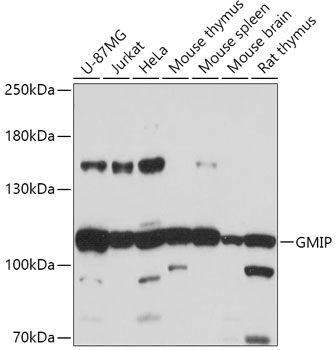 Western blot