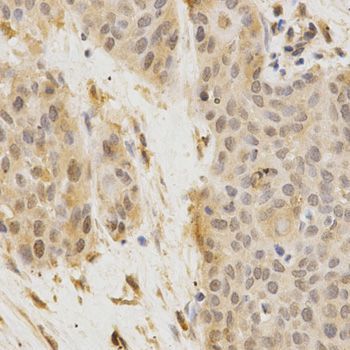 Immunohistochemistry - GGA2 Antibody (144-01186)