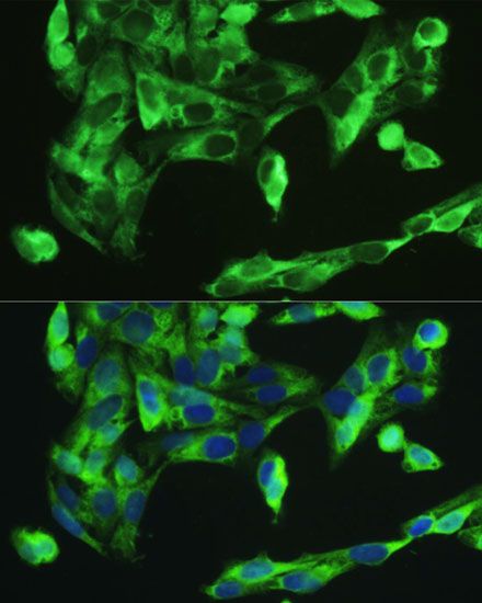 Immunofluorescence - BMP2 Polyclonal Antibody (144-00231)