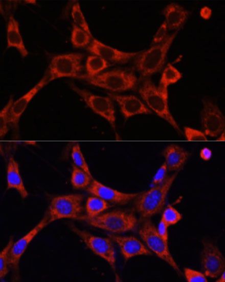 Immunofluorescence - IRAK1 antibody (144-600844)