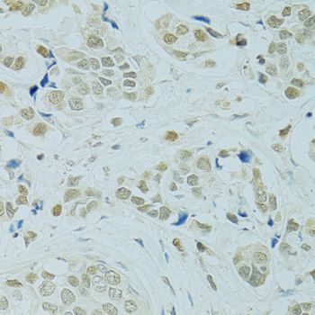 Immunohistochemistry - RCC1 Polyclonal Antibody (144-06350)