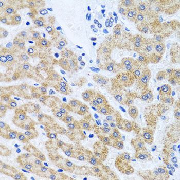 Immunohistochemistry - SCO1 antibody (144-06734)