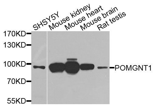 Western blot - POMGNT1 antibody (144-09879)