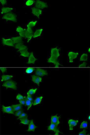 Immunohistochemistry - [KO Validated] GLUL Polyclonal Antibody (144-05437)
