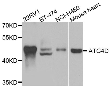 Western blot - ATG4D Polyclonal Antibody (144-07842)