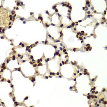 Immunohistochemistry - DDX5 antibody (144-60268)