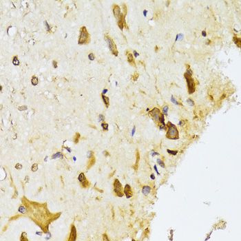 Immunohistochemistry - RPL13 Polyclonal Antibody (144-06723)