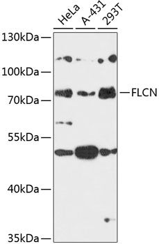Western blot