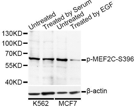 Western blot - Phospho-MEF2C-S396 antibody (144-50075)