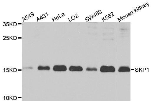 Western blot - SKP1 antibody (144-02566)