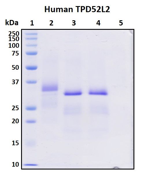 SDS-PAGE