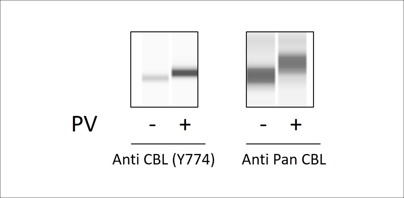 CBL (Tyr1774) - Western Blot
