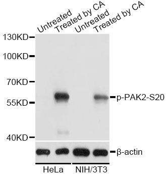 Western blot - Phospho-PAK2-S20 antibody (144-61527)