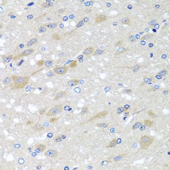 Immunohistochemistry - [KO Validated] NDUFS3 Polyclonal Antibody (144-08013)