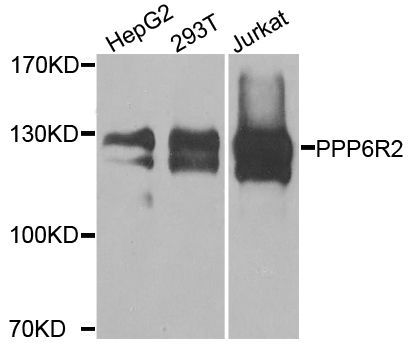 Western blot - PPP6R2 antibody (144-08359)
