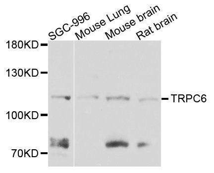 Western blot - TRPC6 antibody (144-08155)