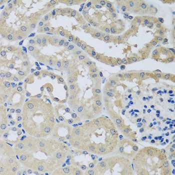 Immunohistochemistry - CHMP1B antibody (144-08239)