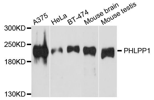 Western blot - PHLPP1 antibody (144-09542)