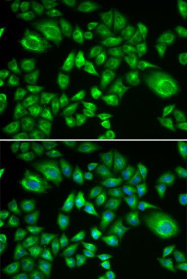 Immunofluorescence - H6PD Polyclonal Antibody (144-06440)