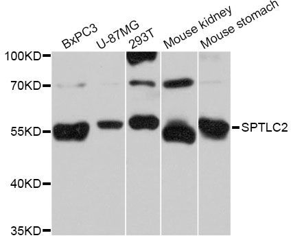 Western blot - SPTLC2 Antibody (144-011716)