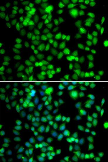Immunofluorescence - FKBP6 Polyclonal Antibody (144-07013)