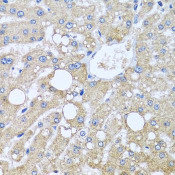 Immunohistochemistry - TUBGCP3 antibody (144-04417)