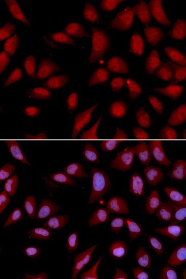 Immunofluorescence - DLGAP5 antibody (144-02197)