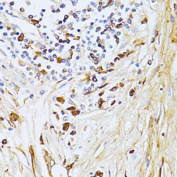Immunohistochemistry - TGFBI antibody (144-02561)