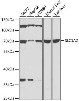 Western blot - SLC1A2 Polyclonal Antibody (144-00910)