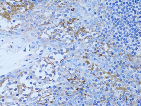 Immunohistochemistry - HADH Polyclonal Antibody (144-01076)