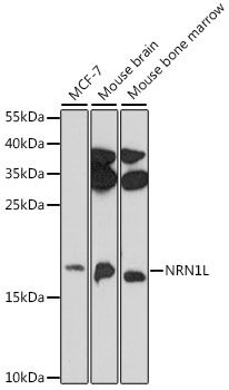 Western blot