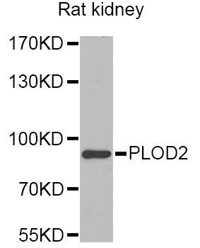 Western blot - PLOD2 Antibody (144-06946)
