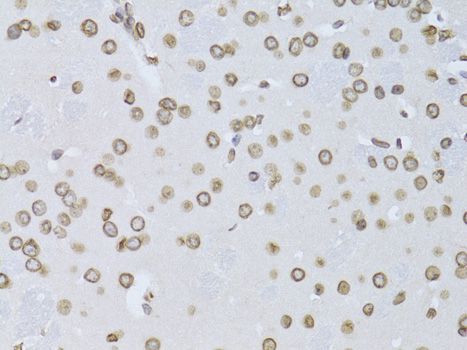 Immunohistochemistry - LMNB2 Polyclonal Antibody (144-06483)
