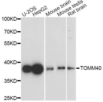 Western blot - TOMM40 antibody (144-61359)