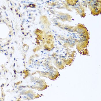 Western blot - VTN Polyclonal Antibody (144-61313)