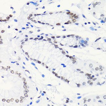 Immunohistochemistry - Acetyl-Histone H4-K5 pAb (144-60957)