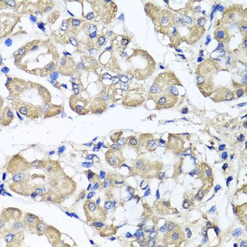 Immunohistochemistry - BCS1L antibody (144-07647)