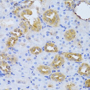 Immunohistochemistry - FDPS Polyclonal Antibody (144-05744)
