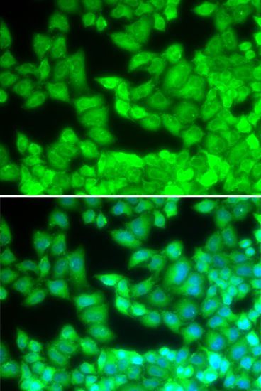 Immunofluorescence - CD40LG Polyclonal Antibody (144-00327)