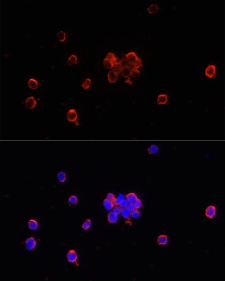 Immunofluorescence - CD47 Polyclonal Antibody (144-01838)