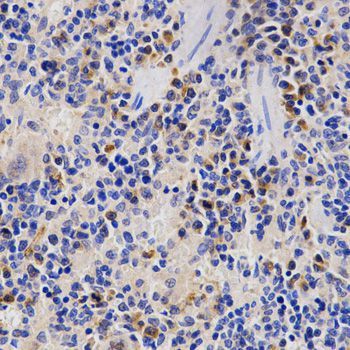 Immunohistochemistry - PSMD3 Polyclonal Antibody (144-02790)