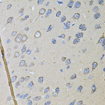 Immunohistochemistry - CDH16 antibody (144-07882)
