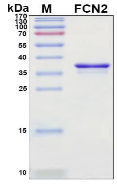 SDS-PAGE Image